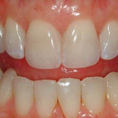 Profile Picture of John_Beals (@Deltadetails) on Twitter