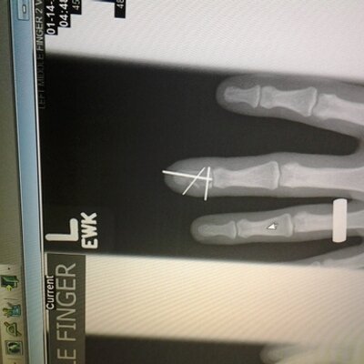 Profile Picture of Jeff Samp (@Roos_34) on Twitter