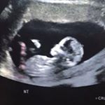 Profile Picture of Adam Griggs (@griggs5563) on Instagram