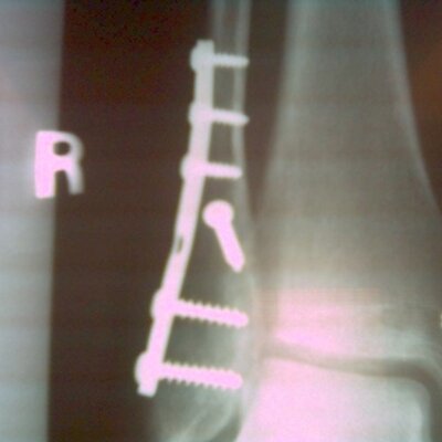 Profile Picture of Tim Stump (@slimslump) on Twitter