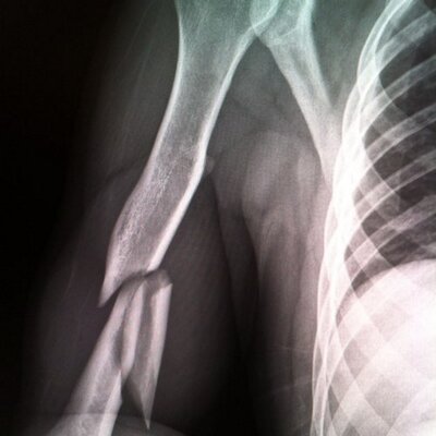 Profile Picture of Steve Holtz (@SteveHoltz2) on Twitter