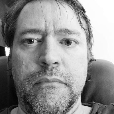 Profile Picture of Josh Hutchinson (@Fibrotramp) on Twitter