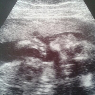 Profile Picture of Miriam Aguado (@AguadoGarciaMir) on Twitter