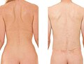 Profile Picture of Human back - Wikipediaon Wikipedia