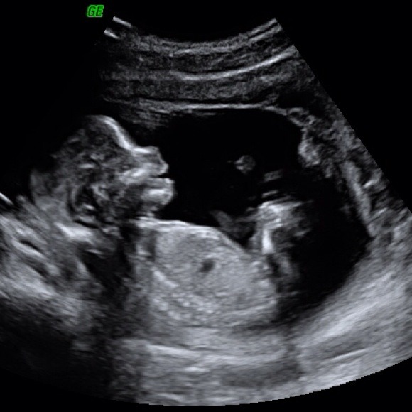 Profile Picture of Colleen Braccio (@ckbraccio) on Poshmark