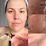 Profile Picture of Kim Wakefield (@makingthemostofskin) on Instagram