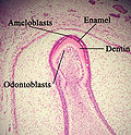 Profile Picture of Molar incisor hypomineralisationon Wikipedia