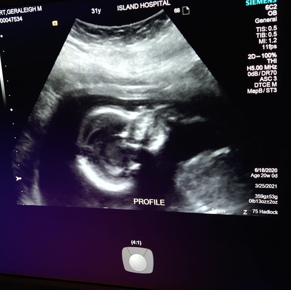 Profile Picture of Geraleigh Hort (@leighleigh89) on Poshmark