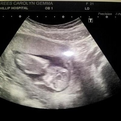 Profile Picture of Gemma Rees (@Carolyn_Gemma) on Twitter