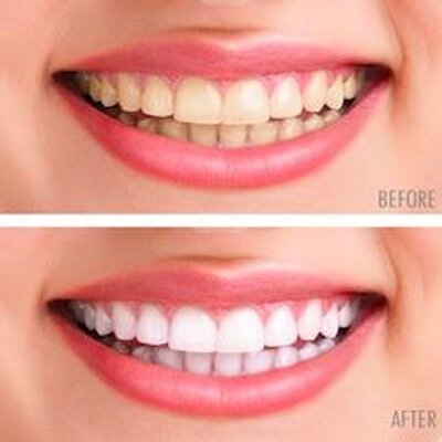 Profile Picture of Anthony Cordina (@@verybrightsmile) on Twitter