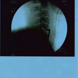 Profile Picture of Jonas Miller (@rabbitt1975) on Myspace