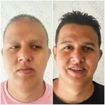 Profile Picture of Juan Carlos Aristizabal Gomez (@cabellosypiel) on Instagram