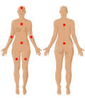 Profile Picture of Fibromyalgia - Wikipediaon Wikipedia