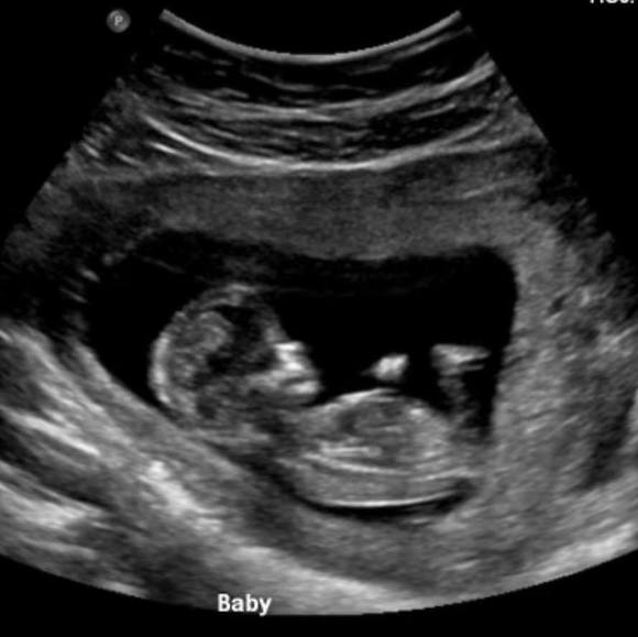 Profile Picture of Mannette Juan-quitzon (@jonjules2) on Poshmark