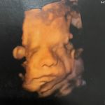 Profile Picture of Thomas Russinho (@thomyrussinho) on Instagram