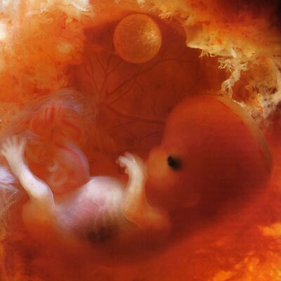 Martha Villarreal - Twitter Profile Picture of Martha Villarreal (@MaPatVillarreal) on Twitter