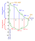 Profile Picture of Spirometryon Wikipedia