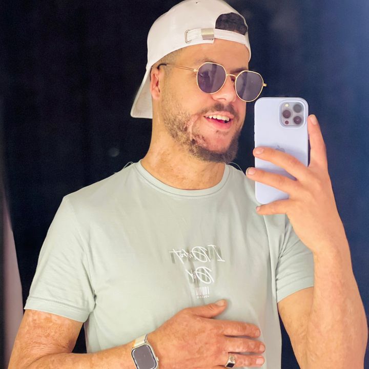 Profile Picture of Karem Mohamed (@karem.mohamed3668) on Tiktok