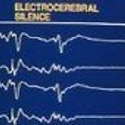 Profile Picture of Jonathan Beckett (@KevinFinnerty) on Twitter