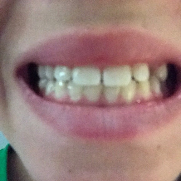 Profile Picture of Zachary Melinger (@zmeli56) on Poshmark