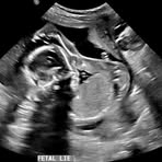 Profile Picture of Gavin Filas (@gavin.filas.75) on Facebook