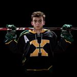 Profile Picture of Alex Chester (@a13x_chester) on Instagram