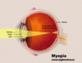 Profile Picture of Myopiaon Wikipedia