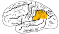 Profile Picture of Gerstmann syndromeon Wikipedia