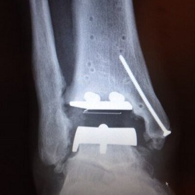 Profile Picture of Randy Erickson (@shankopotomus64) on Twitter