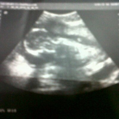 Profile Picture of Lauren Teran Correa (@lauterancorrea) on Twitter