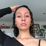 Profile Picture of Deanna Blake | Acne Journey (@deannaskin) on Instagram