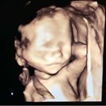 Leonardo Pearlman - Instagram Profile Picture of Leonardo Pearlman (@leonardo_james_pearlman) on Instagram