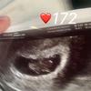 Profile Picture of Zach Ramsey (@@ramjet1021) on Tiktok
