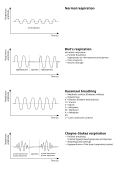 Profile Picture of Cheyne–Stokes respiration - Wikipediaon Wikipedia