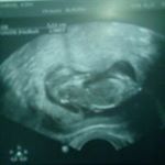 Profile Picture of Kevin Hassenzahl (@kevinhassenzahl) on Instagram