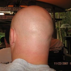 Profile Picture of Chris Grinnell (@baldgmoney) on Myspace